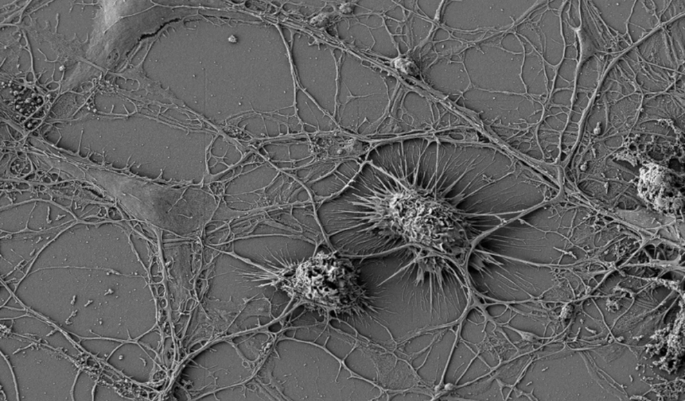 Tunneling nanotubes (TNTs) verbinden Neuronen direkt